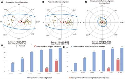 Total keratometry for toric intraocular lens calculation: comparison from two swept-source optical coherence tomography biometers